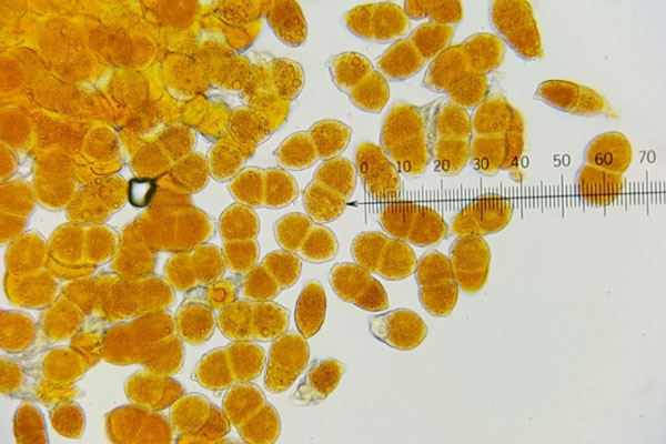 Teliospores of the cedar-quince rust pathogen under a compound microscope