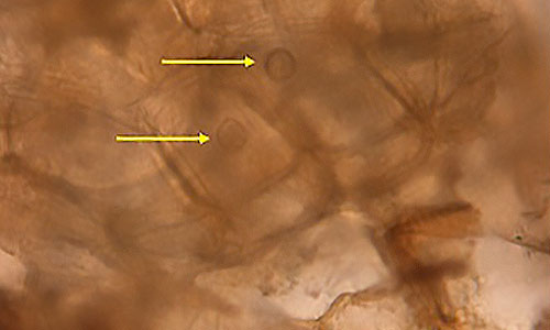 Pythium oospores observed in symptomatic root tissues