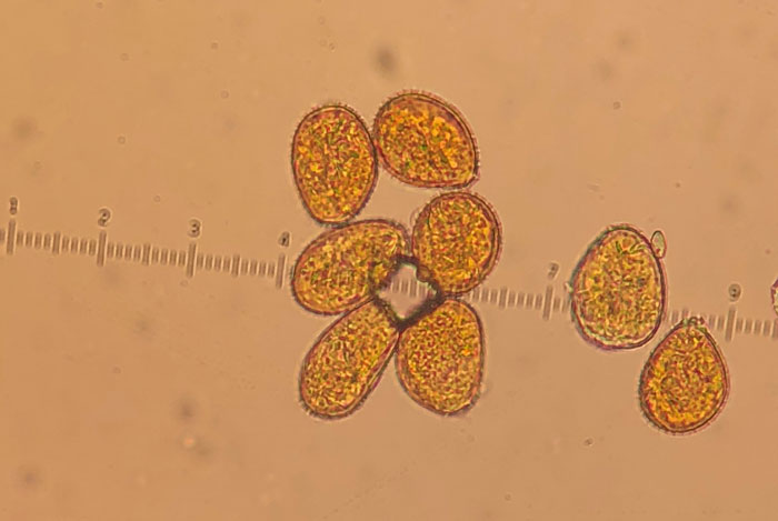 Spores of Puccinia polysora