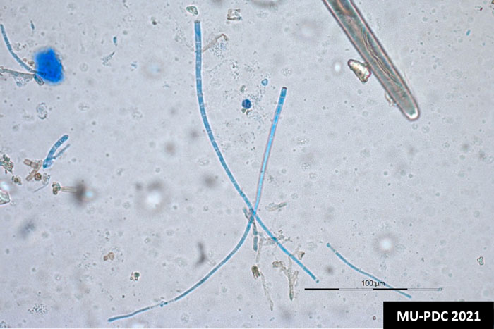 blues strands under microscope