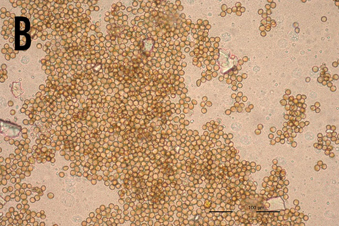 microscope image of barley head showing numerous small bunches of transparent circles